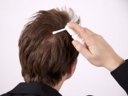 Premature Graying of Hair
