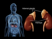 15 Ways to Treat Hypothyroidism Naturally