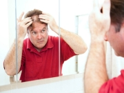 20 Home remedies for hair care in men