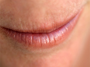Natural Tips to Cure Chapped Lips 