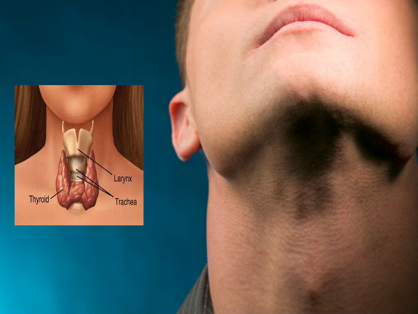 Natural Remedies For Thyroid Problem
