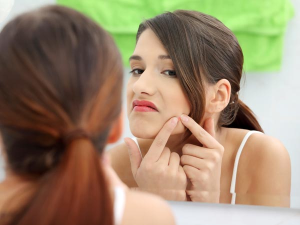 ಮೊಡವೆಗಳಿಗೆ (acne)