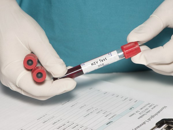 (HIV) ಎಂದರೇನು?