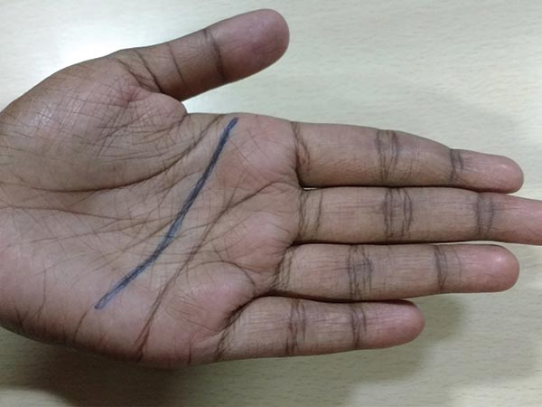 ತಲೆ ಗೆರೆ