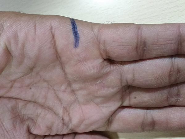 ಮದುವೆ ರೇಖೆ
