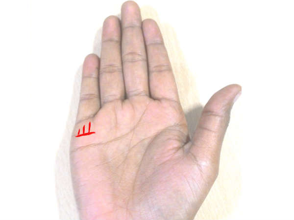 ಮಗುವಿನ ಆರೋಗ್ಯದಲ್ಲಿ ತೊಂದರೆ