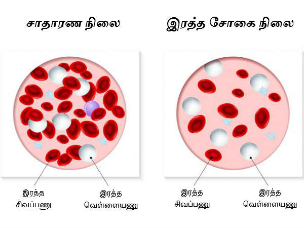ರಕ್ತಹೀನತೆಯ ಸಾಧ್ಯತೆಯನ್ನು ಕಡಿಮೆ ಮಾಡುತ್ತದೆ