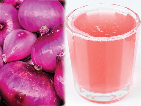 ಕೂದಲ ಬೆಳವಣಿಗೆಯಲ್ಲಿ ಈರುಳ್ಳಿ ರಸ