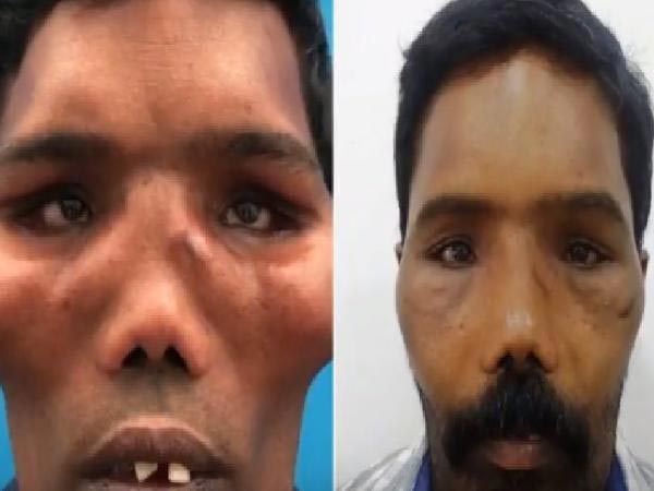 ಇವೆಲ್ಲಾ ಪ್ಲಾಸ್ಟಿಕ್ ಸರ್ಜರಿ ಮಹಿಮೆ! ಹೀಗೂ ಉಂಟೇ..?