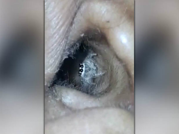 ಆಕೆಯ ಕಿವಿಯೊಳಗೇನಾಗುತ್ತಿದೆ ಎಂದೇ ಆಕೆಗೆ ಗೊತ್ತಿರಲಿಲ್ಲ