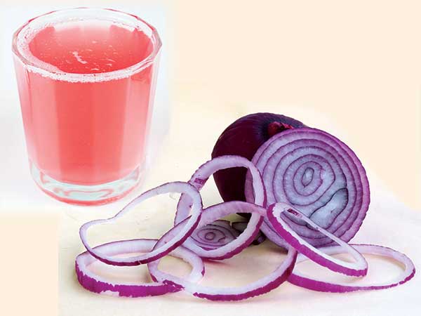 ಈರುಳ್ಳಿ