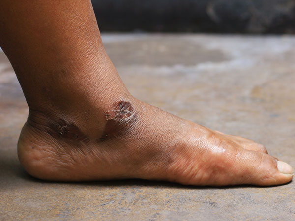 ಬಣ್ಣ ಮತ್ತು ವಿನ್ಯಾಸದಲ್ಲಿ ವ್ಯತ್ಯಾಸವಿರುತ್ತದೆ