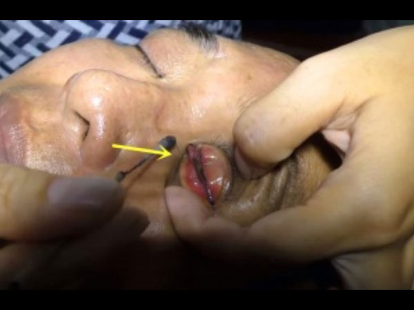 ಕಣ್ಣುಗಳನ್ನು ಸ್ವಚ್ಛ ಮಾಡಿಕೊಳ್ಳುವುದು ಹೇಗೆ?
