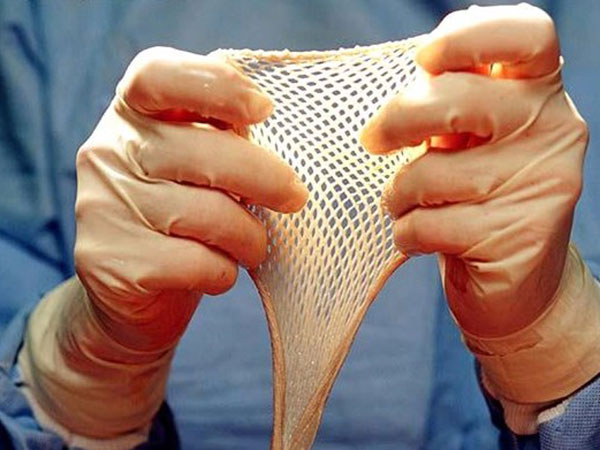ಡರ್ಮಲ್ ಗ್ರಾಫ್ಟಿಂಗ್(Dermal Grafting)