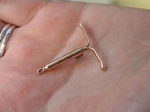 2. IUDs (ಕಾಪರ್ಟಿ)