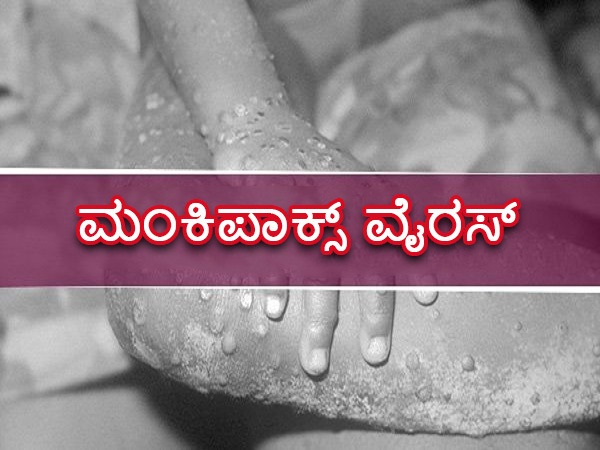 ಮಂಕಿಪಾಕ್ಸ್ ಲಕ್ಷಣಗಳೇನು?